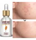 ROREC White Rice Face Serum Whitening Essence 15ml